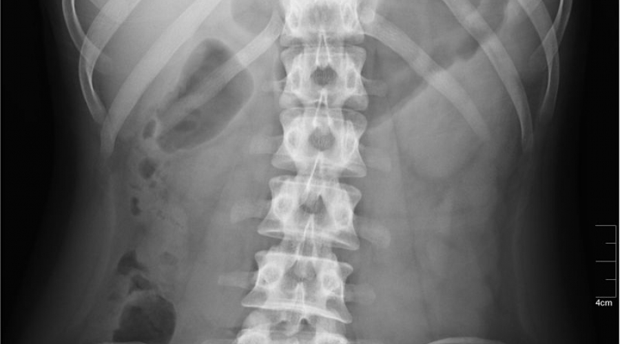 abdominal x ray