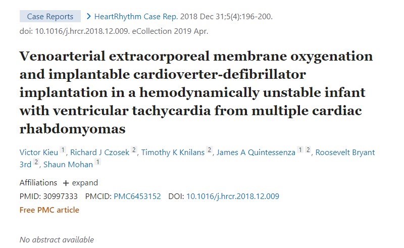 Venoarterial extracorporeal membrane oxygenation and implantable cardioverter-defibrillator implantation in a hemodynamically unstable infant with ventricular tachycardia from multiple cardiac rhabdomyomas