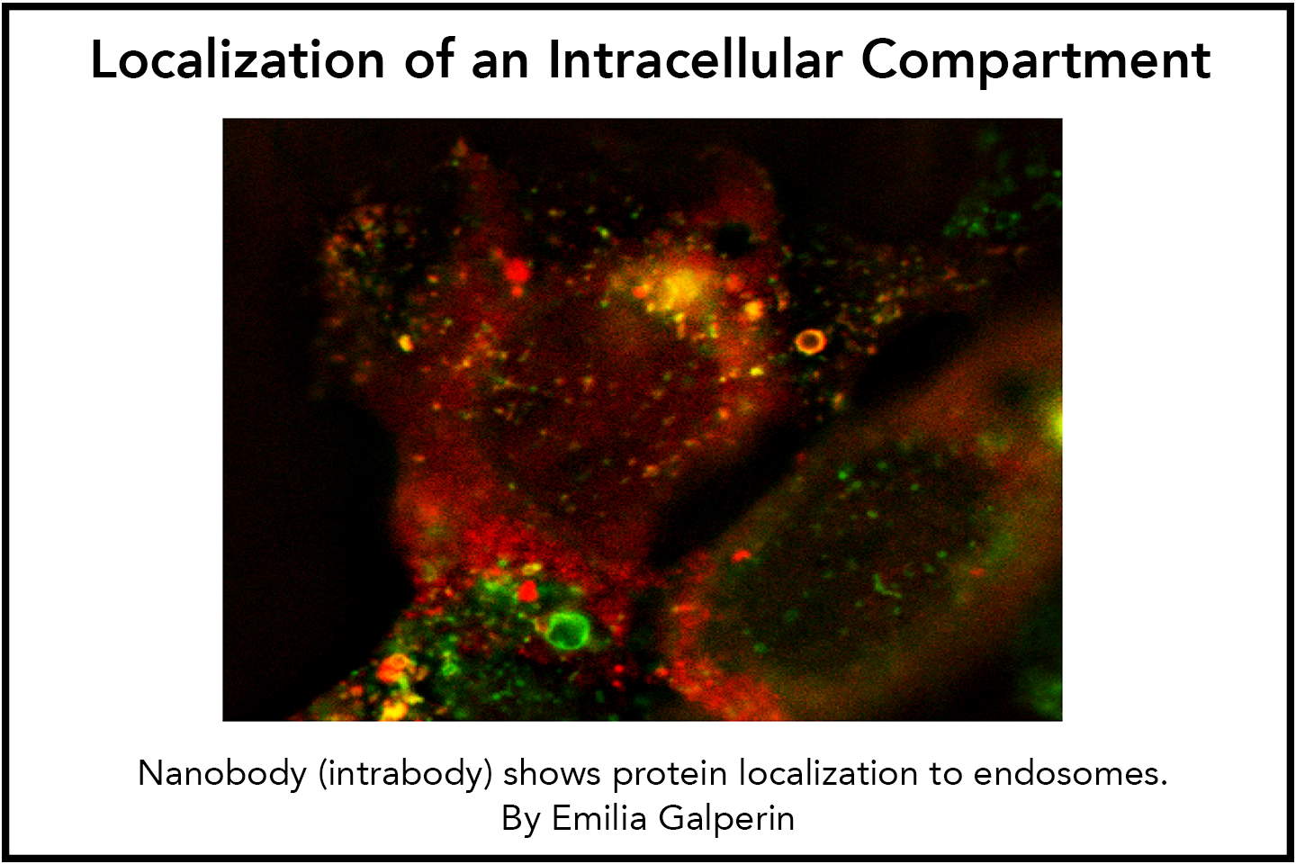 Localization of an Intracellular Compartment: Nanobody (intrabody) shows protein localization to endosomes.
