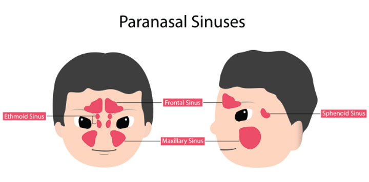 Paranasal Sinuses: forward-facing and side-facing images of cartoon heads with the sinuses highlighted
