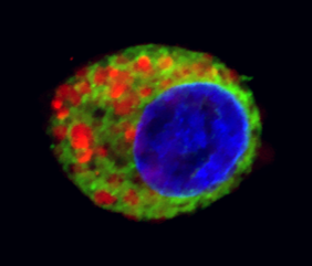 Costaining of AGT and endoplasmic reticulum (ER) in cultured HepG2 cells transducted with AAV.loop/βsheet-Mut. Scale bar, 10 μm.