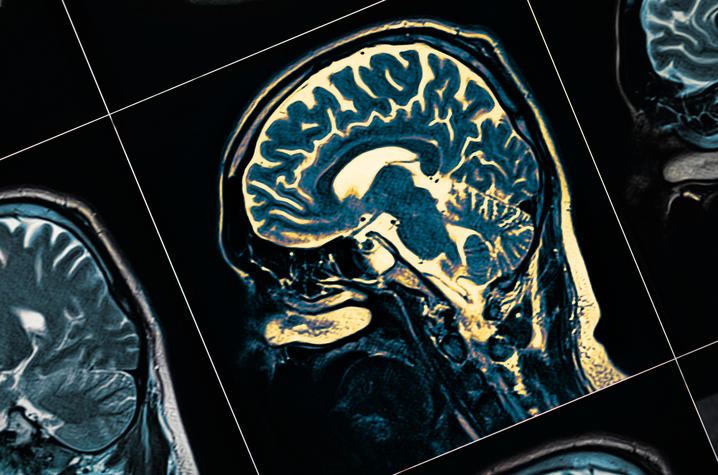 Close up of a brain scan