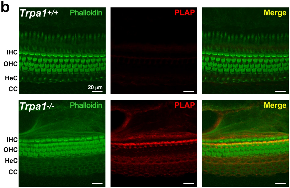 Confocal images of cochlear epithelia (P4) at low magnification in wild-type (top) and Trpa1–/– (bottom) littermates showing PLAP immunolabeling (red) and counterstaining of F-actin with phalloidin (green). The images were kindly provided by Drs. Kevin Kwan and David Corey. 