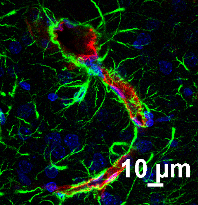 astrocyte around brain blood vessel