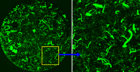 green labeled mitochondria in brain blood vessels