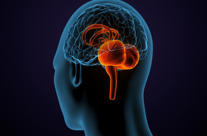 A medical illustration of a human head, highlighting the cerebellum in the brain.