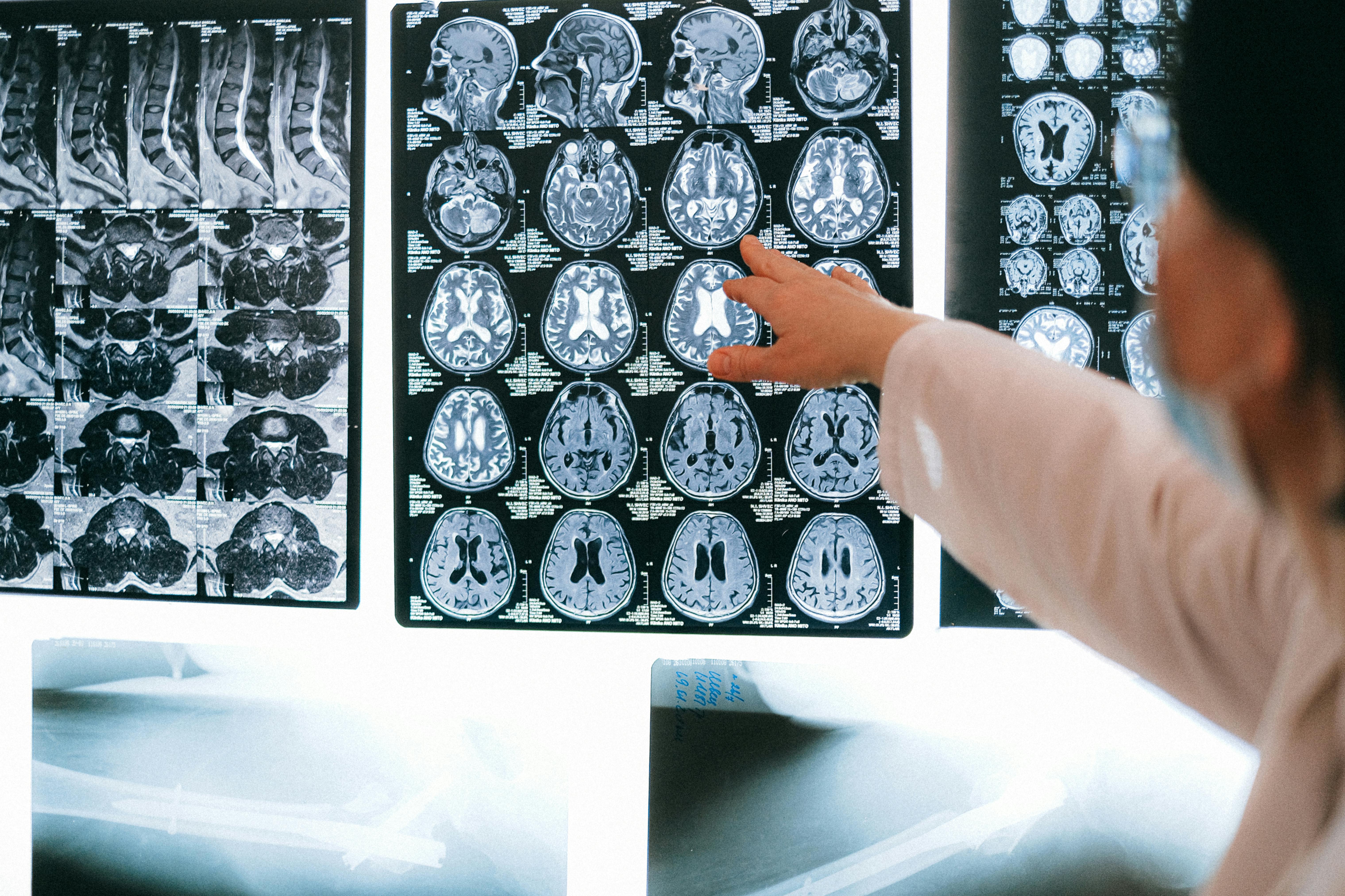 A doctor referencing a patient's brain scans.