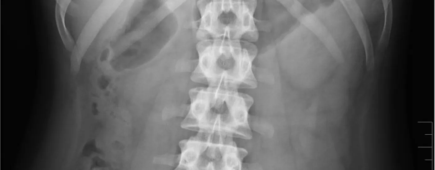 abdominal x ray