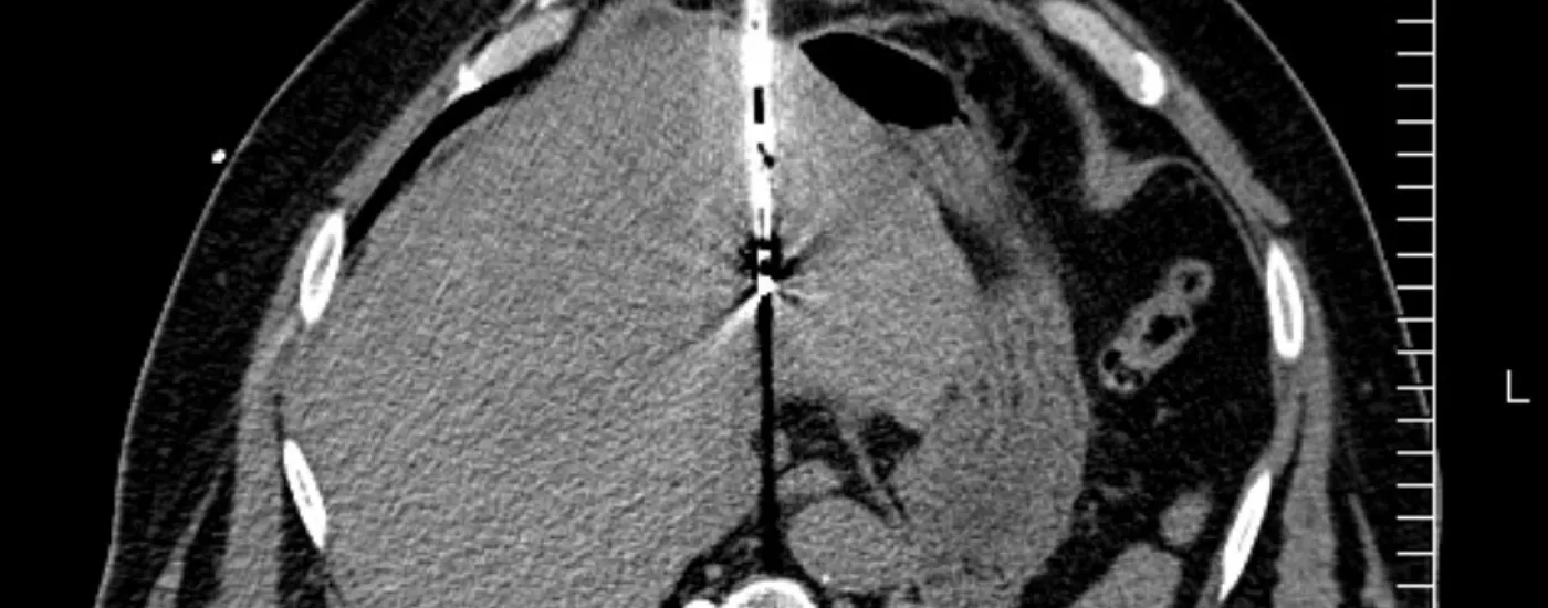 Screened image of heart