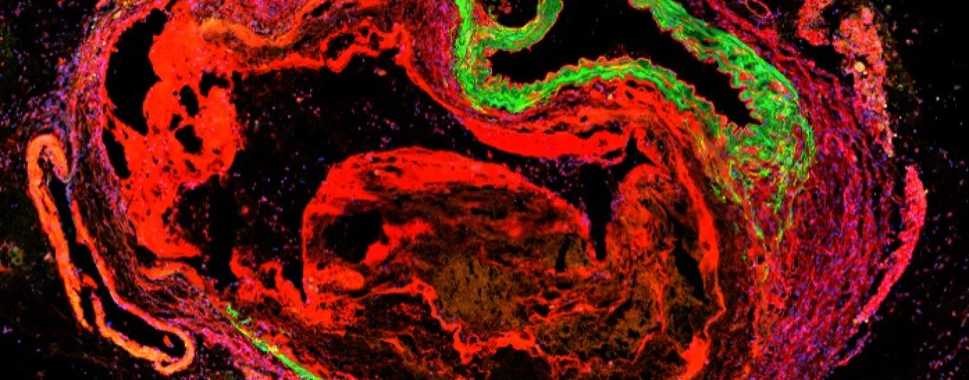 Stained Aorta
