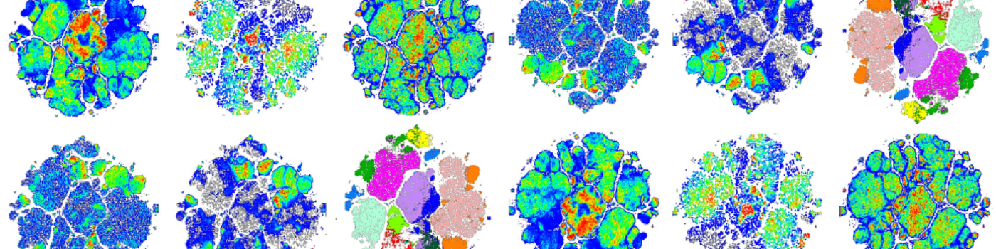 collage of multicolored images of brain scans