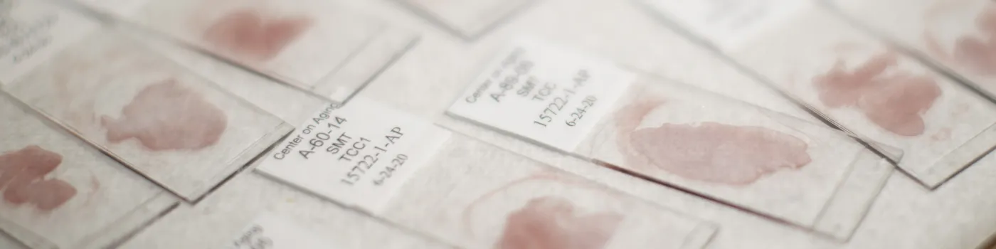 Brain Tissue