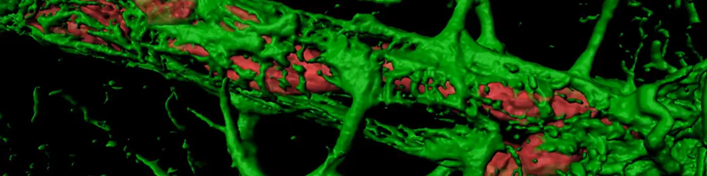 Astrocyte