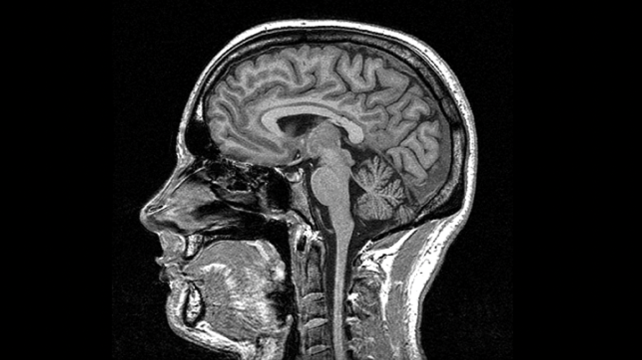 X-Ray of the human skull and mind.