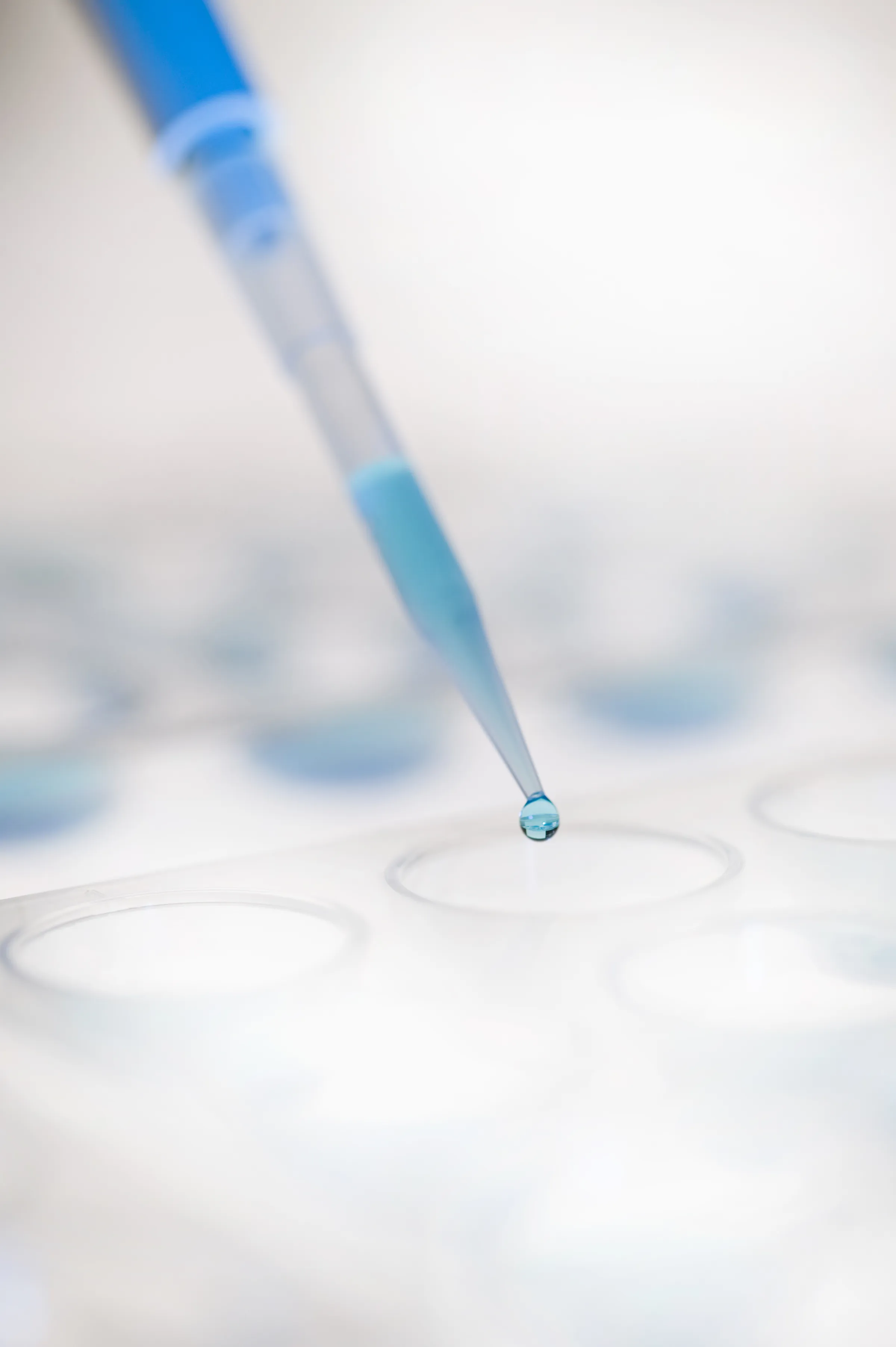 A dropper ready to drop fluid into a petri dish.