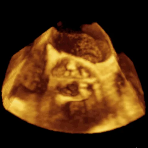 clinical scan of heart