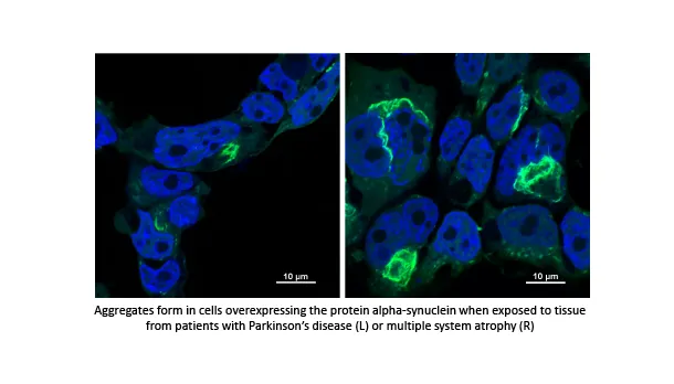 two images and a short explanation of Dr. Tritia Yamasaki's COBRE project