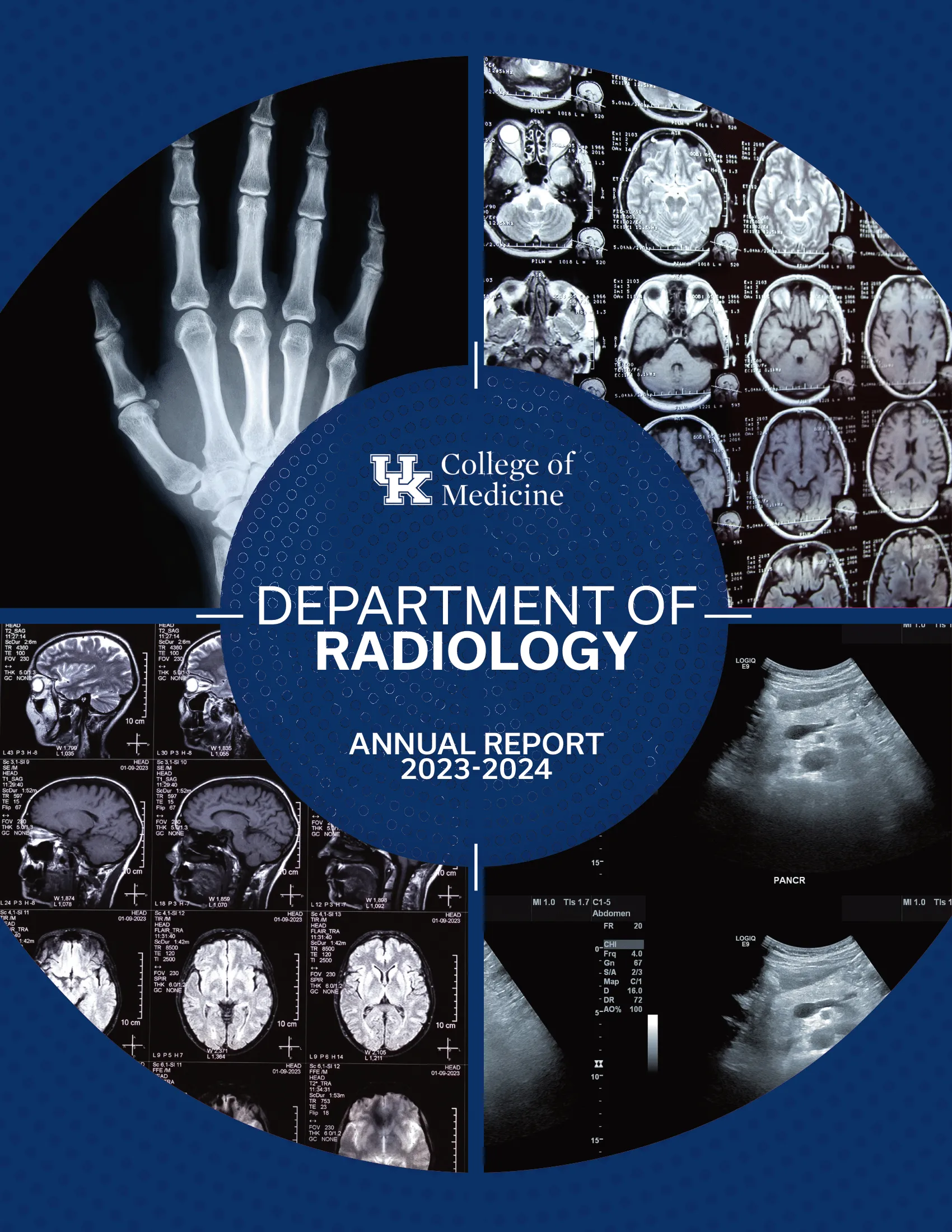 UK College of Medicine Department of Radiology 2023-2024 Annual Report