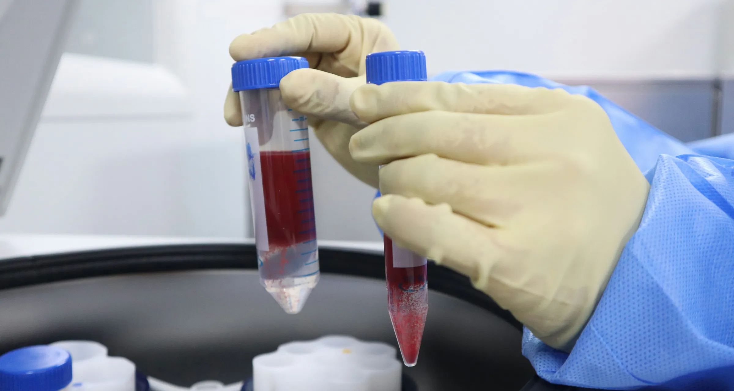 Hands in rubber gloves hold two test tubes of blood