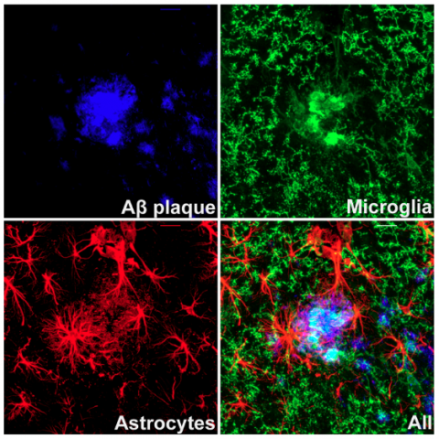Image of amyloid beta plaque (blue), surrounded by microglia (green) and astrocytes (red) from an amyloidosis mouse model. Image credit: James Schwartz, Morganti Lab.