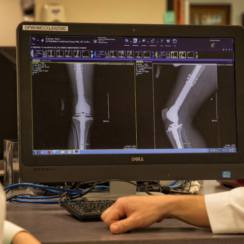 side view of researcher in foreground; xray or scan of knee on computer screen