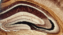 Rat_hippocampus 640.jpg