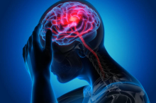 stroke_0.jpg