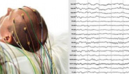 person with electrodes on head and a printout of the test result lines