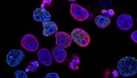 microscopic close up of cells