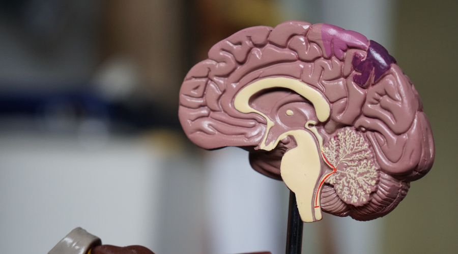 3D model of a human brain