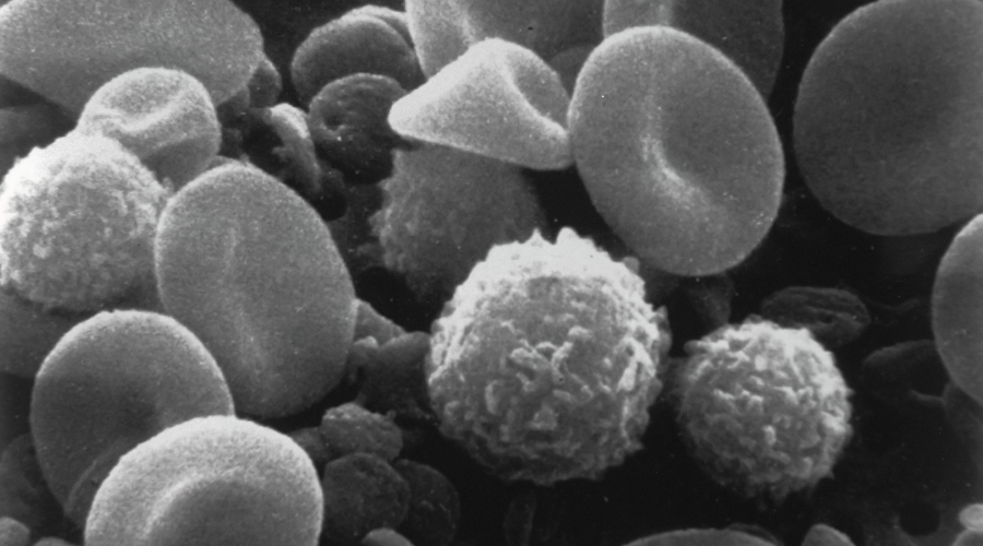 black and white photo of a close-up of blood cells