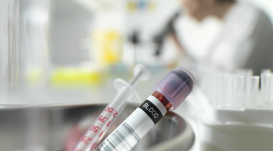 vial of blood in foreground with a researcher in the background