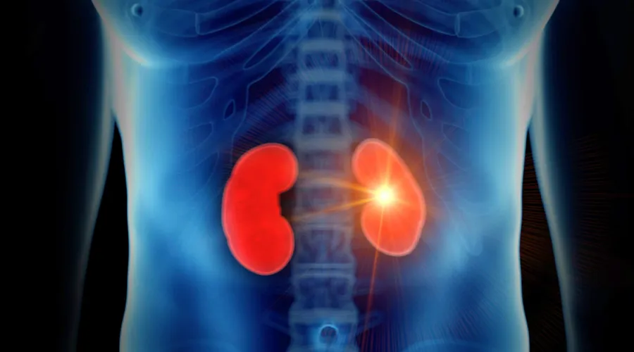 Medical imaging of kidneys