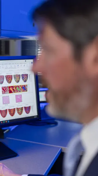 A man sitting at a computer. The man's face is out of focus so that the computer models of fibrosis are emphasized.
